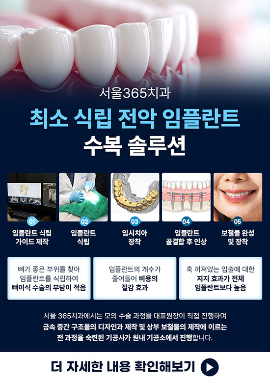 최소 식립 전악 임플란트
