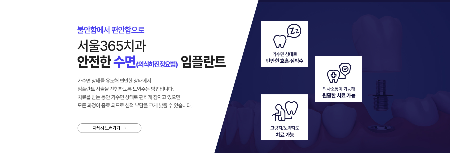 수면 임플란트
